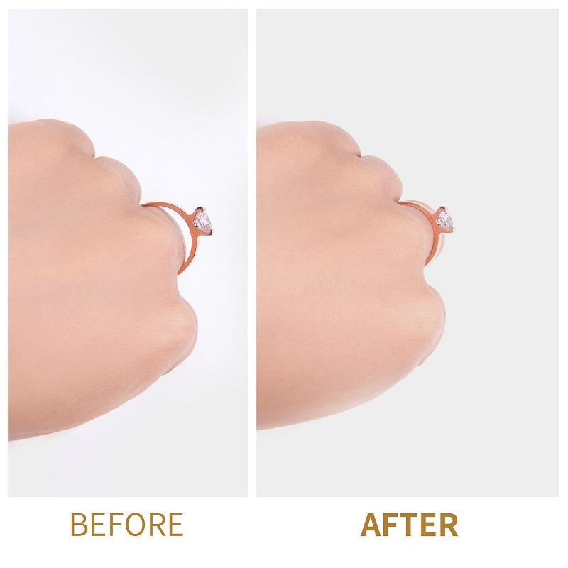 Size adjustable silicone ring cushion